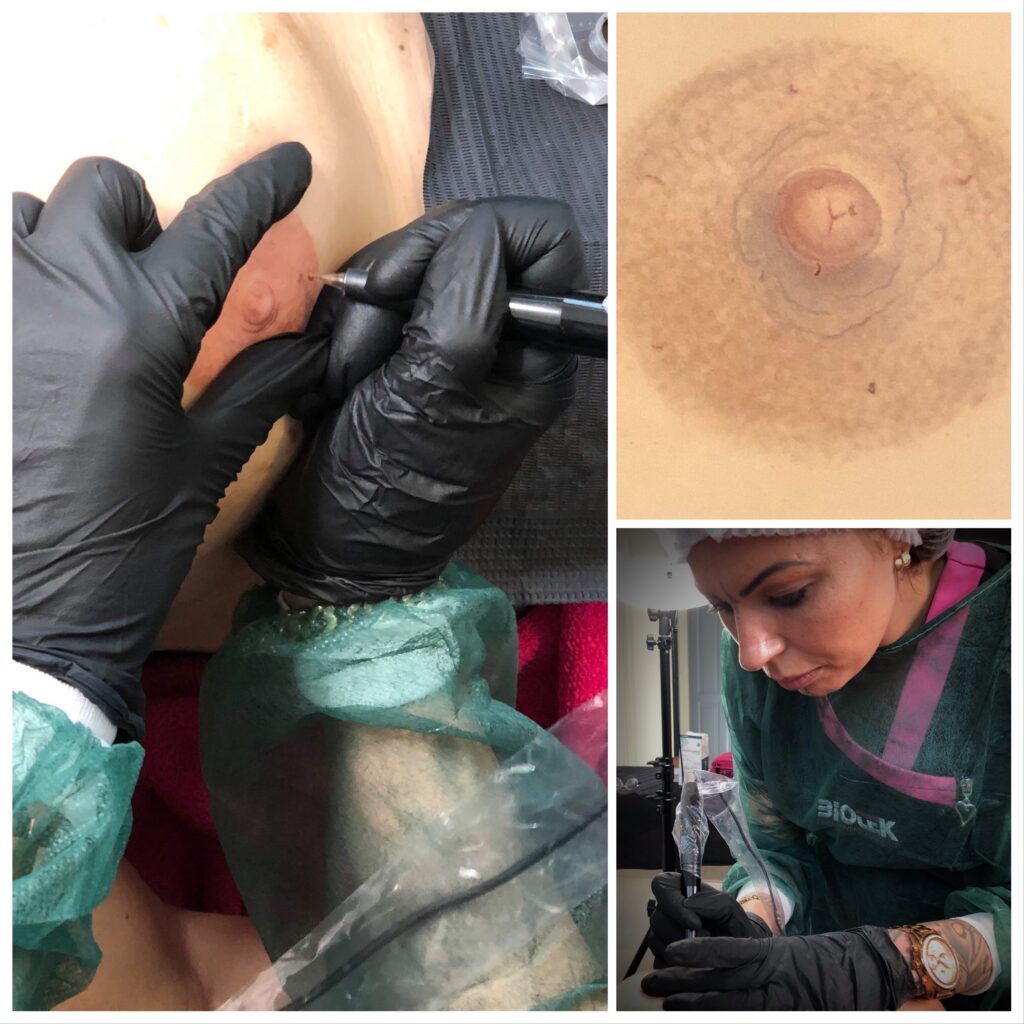 medicinsk tatovering areolatattoo 3d brystvorte tatoveret brystvorte mastektomitattoo enhanced by malina girlz inc